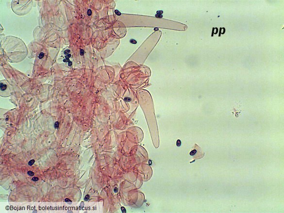 Coprinellus bisporus