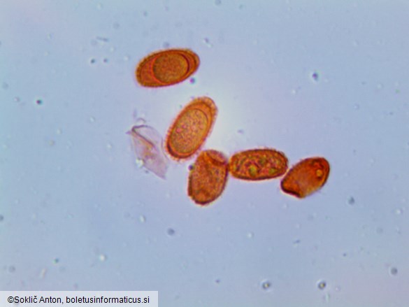 Pachykytospora tuberculosa