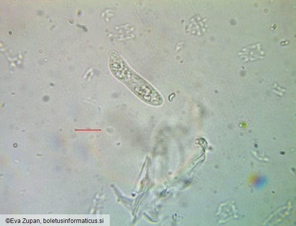 Platygloea disciformis
