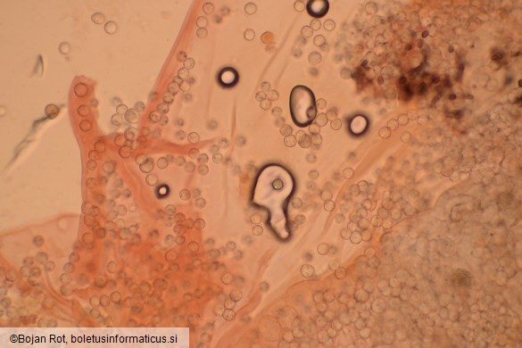 Arcyria denudata