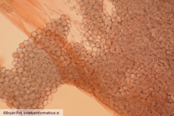 Arcyria denudata