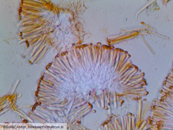 Orbilia auricolor
