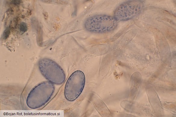 Scutellinia scutellata