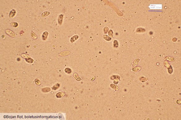 Pseudotricholoma metapodium