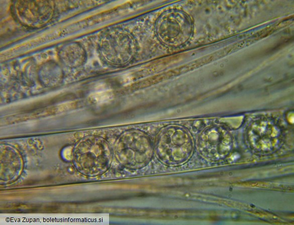 Scutellinia trechispora