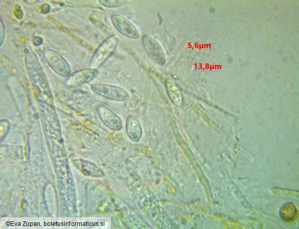 Hymenoscyphus eichleri