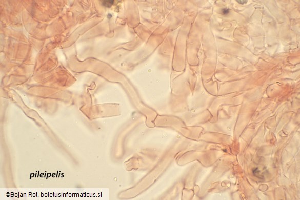 Infundibulicybe trulliformis