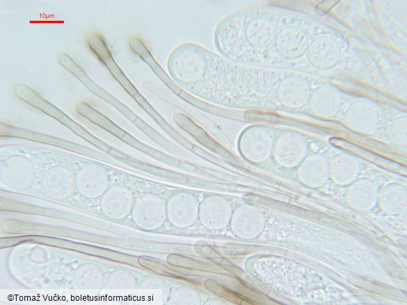 Pseudoplectania nigrella