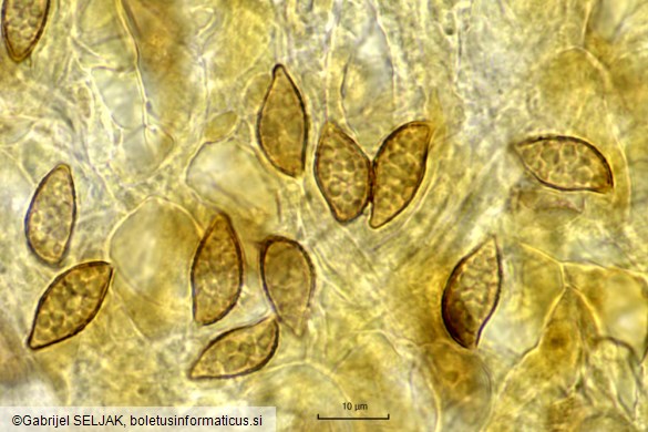 Cortinarius collinitus
