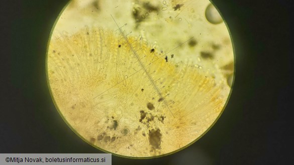 Pyronema omphalodes