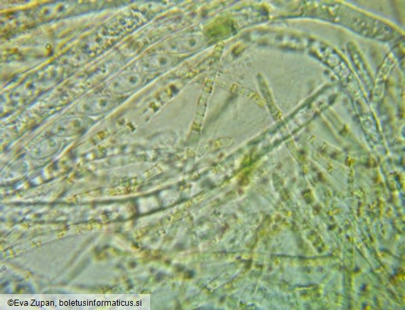 Hymenoscyphus eichleri