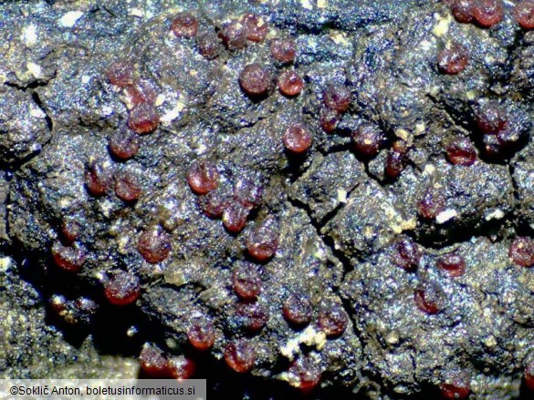 Pseudocosmospora perforaticola