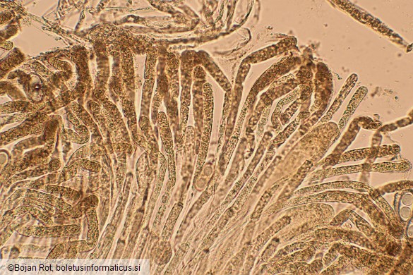 Psilopezia nummularia