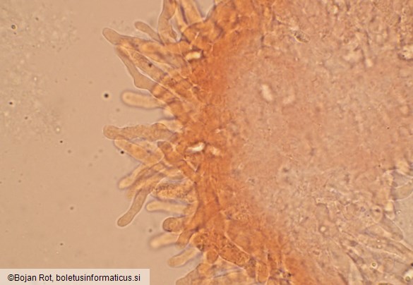 Pseudotricholoma metapodium