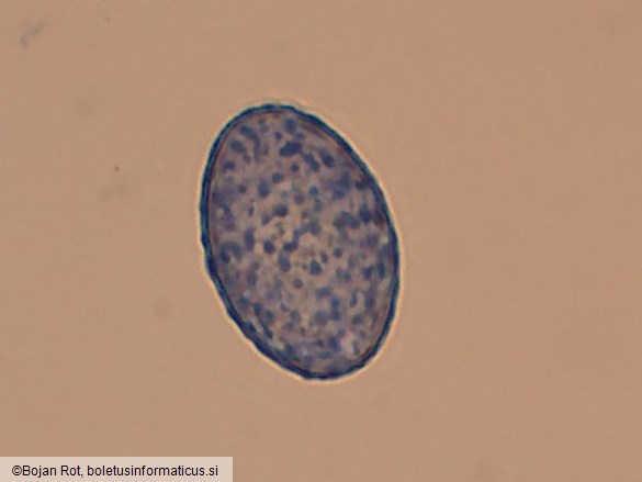 Scutellinia nigrohirtula