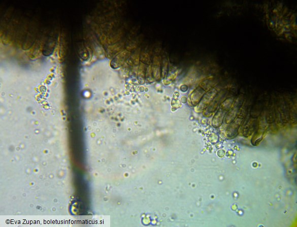 Colletotrichum