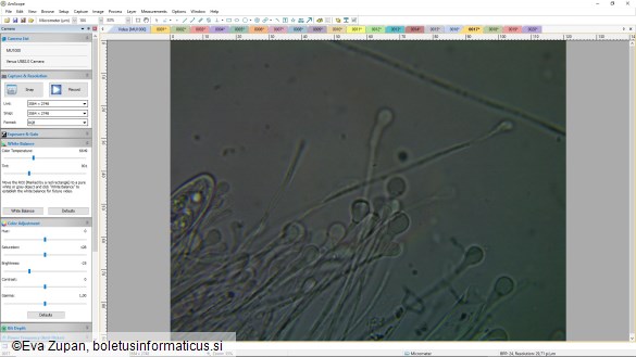 Ascocoryne inflata