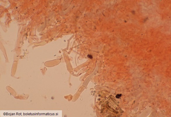 Spodocybe trulliformis