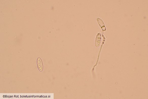 Calycina citrina