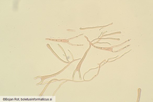 Dacrymyces chrysospermus