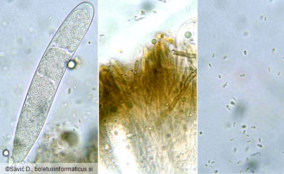 Vexillomyces atrovirens