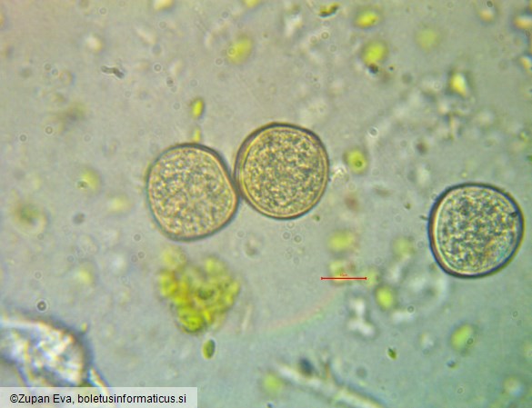 Tranzschelia pruni-spinosae