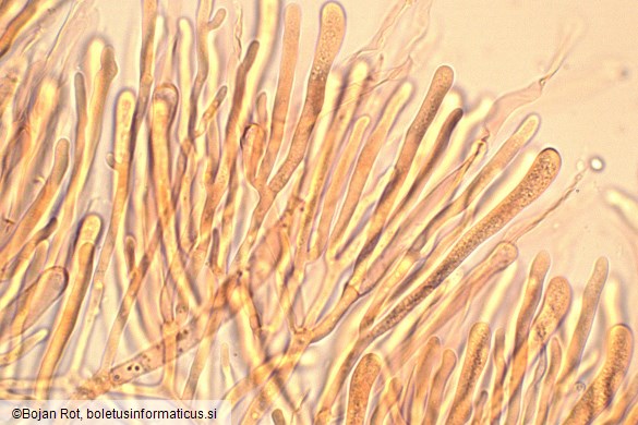 Calocera glossoides