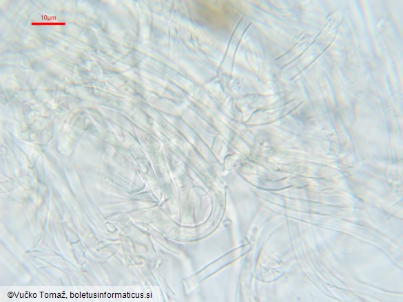 Polycephalomyces ditmarii