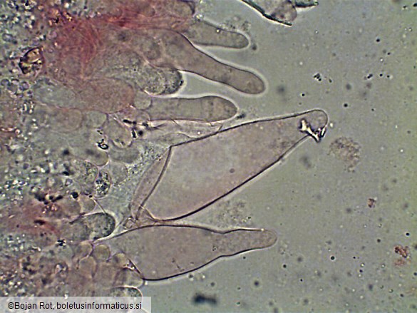 Melanoleuca subalpina