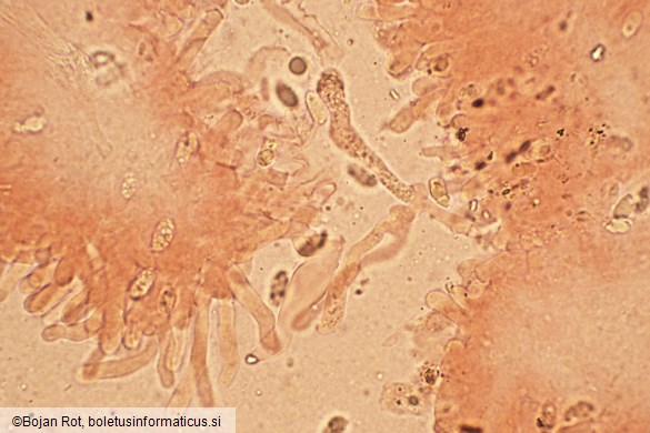 Pseudotricholoma metapodium