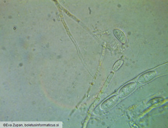 Hymenoscyphus eichleri