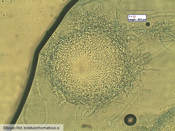 Hypomyces lateritius