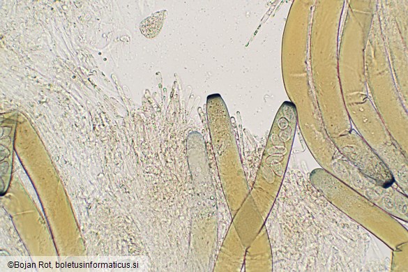 Peziza vesiculosa