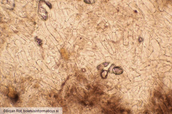 Pseudotricholoma metapodium
