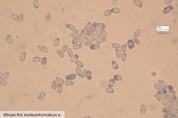 Pseudoporpoloma pes-caprae