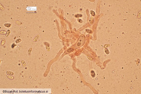 Pseudotricholoma metapodium