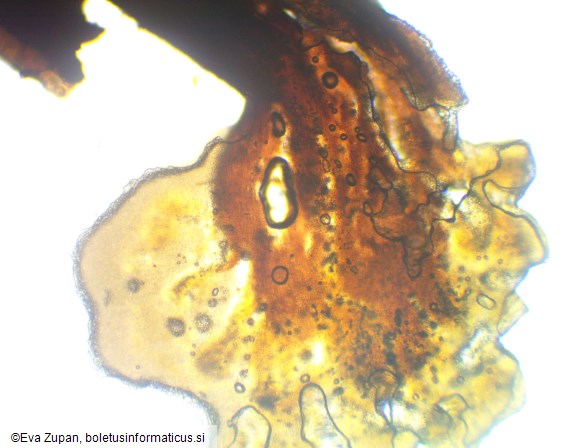 Gracilistilbella clavulata