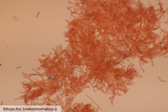 Pseudoporpoloma pes-caprae