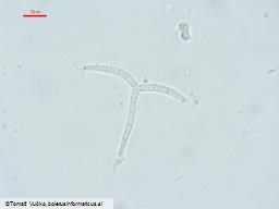 Orbilia pseudoaristata