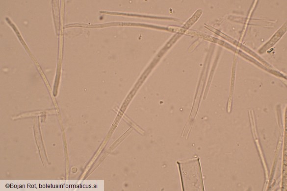 Lanzia luteovirescens