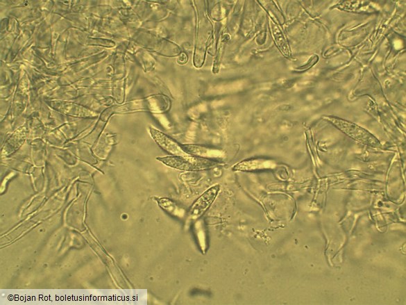 Hypomyces lateritius