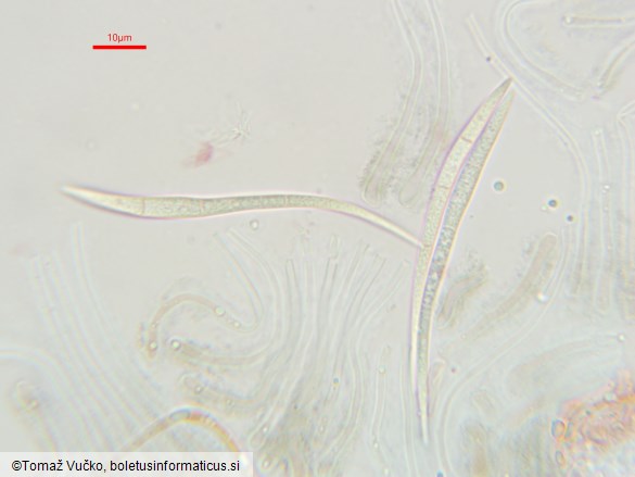 Therrya pini var. pini