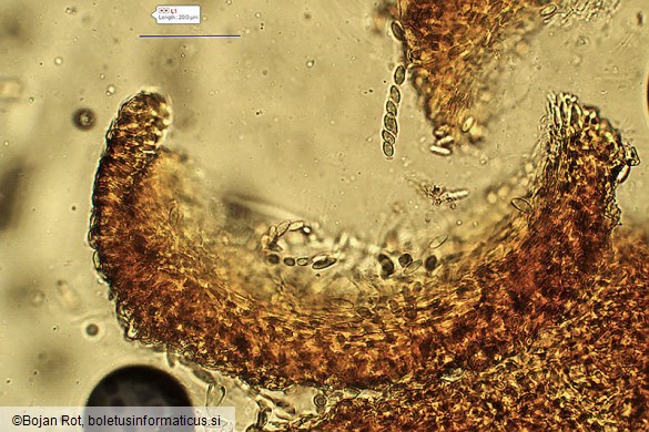 Neonectria punicea