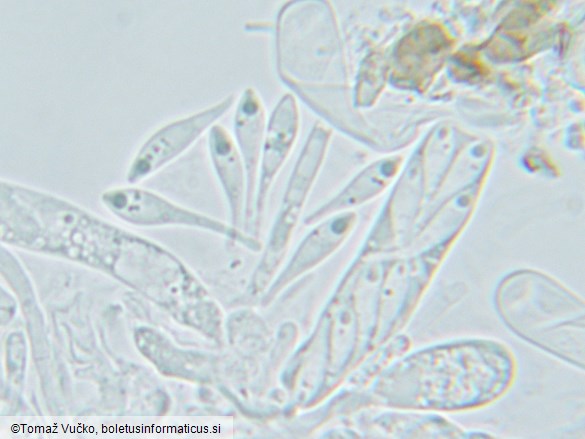 Orbilia pseudoaristata