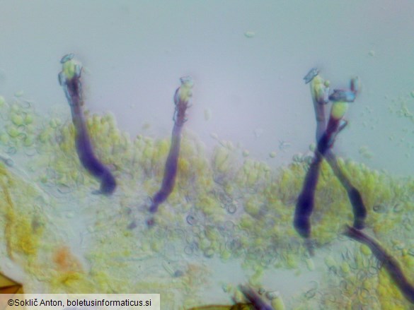 Tubulicrinis strangulatus