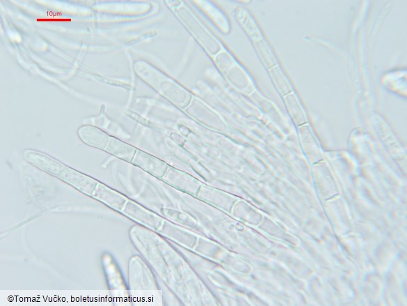 Arachnopeziza leonina