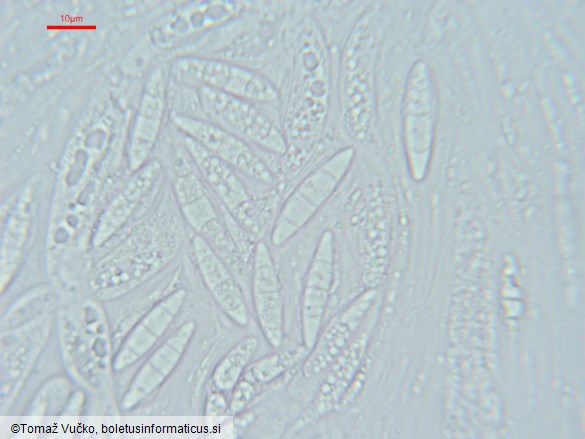 Chaetosphaeria ovoidea