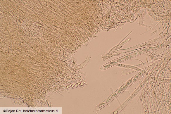 Lanzia luteovirescens