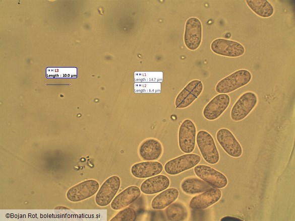 Ceratiomyxa fruticulosa