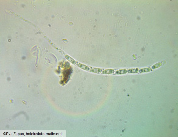 Phomatospora berkeleyi